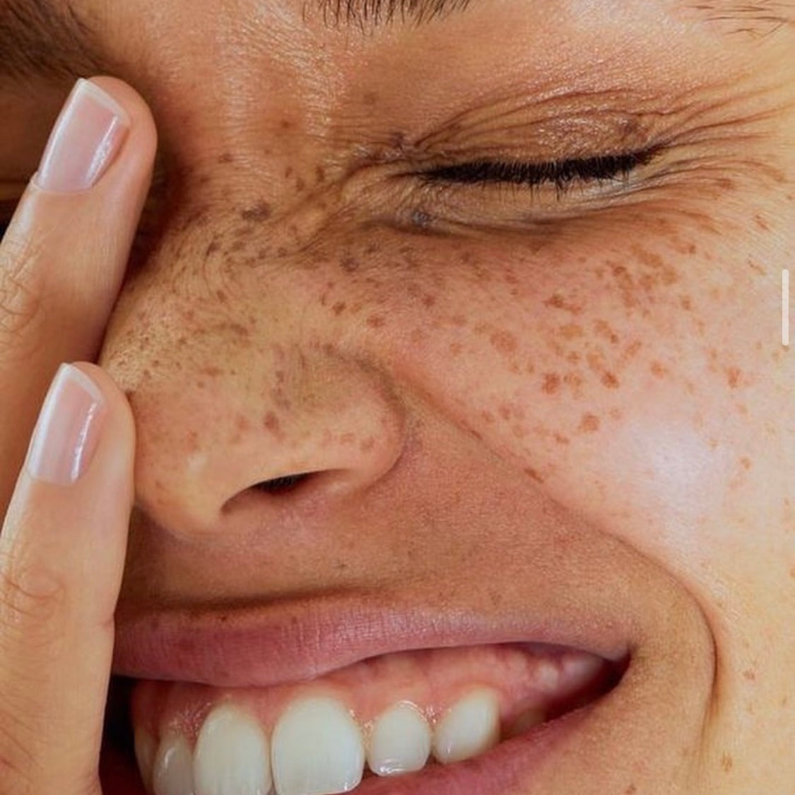 How do Free Radicals Affect Our Skin?