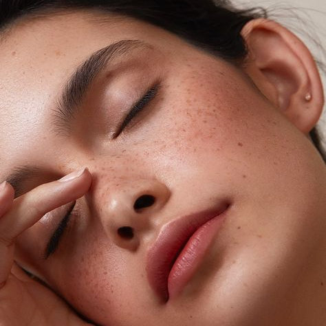 Top Nutrients for Dry Skin