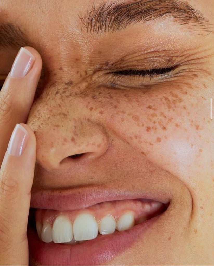 How do Free Radicals Affect Our Skin?